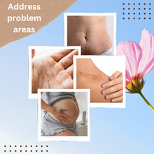 Load image into Gallery viewer, Skin care Oil, Serum for Stretch Mark and Scar oil